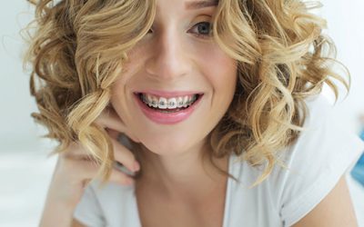 Straight Teeth and Oral Health