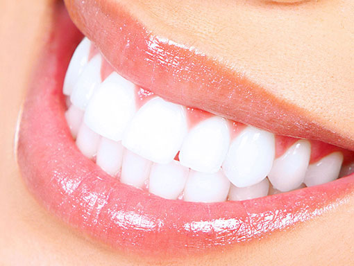 white teeth smiling with healthy gums