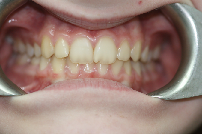 A Shifting Situation